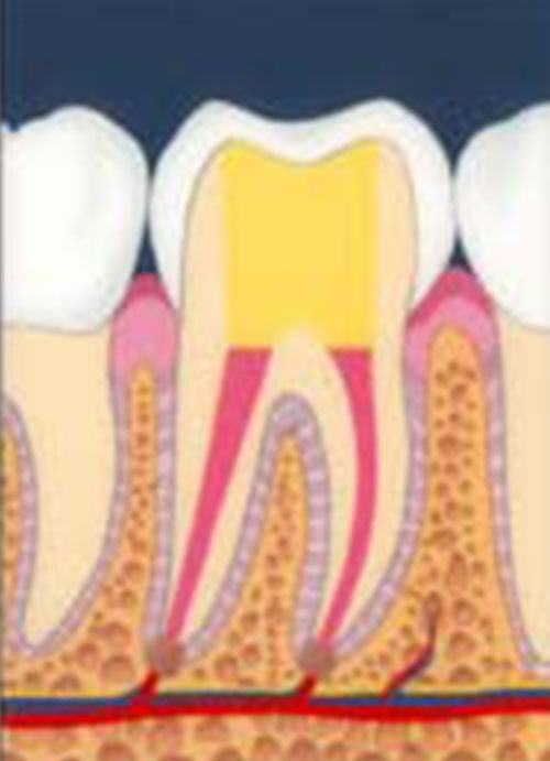 Zahnlücke